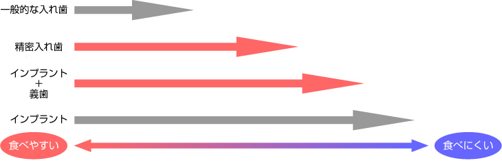 当院のインプラントと入れ歯についての考え方
