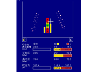 咬合力測定