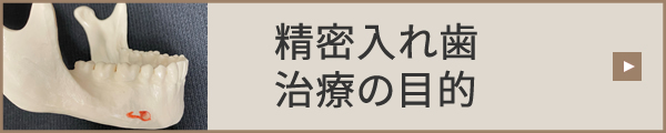 精密入れ歯治療の目的