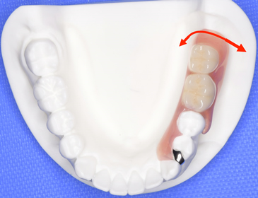 片動きを減少させる装置を使用