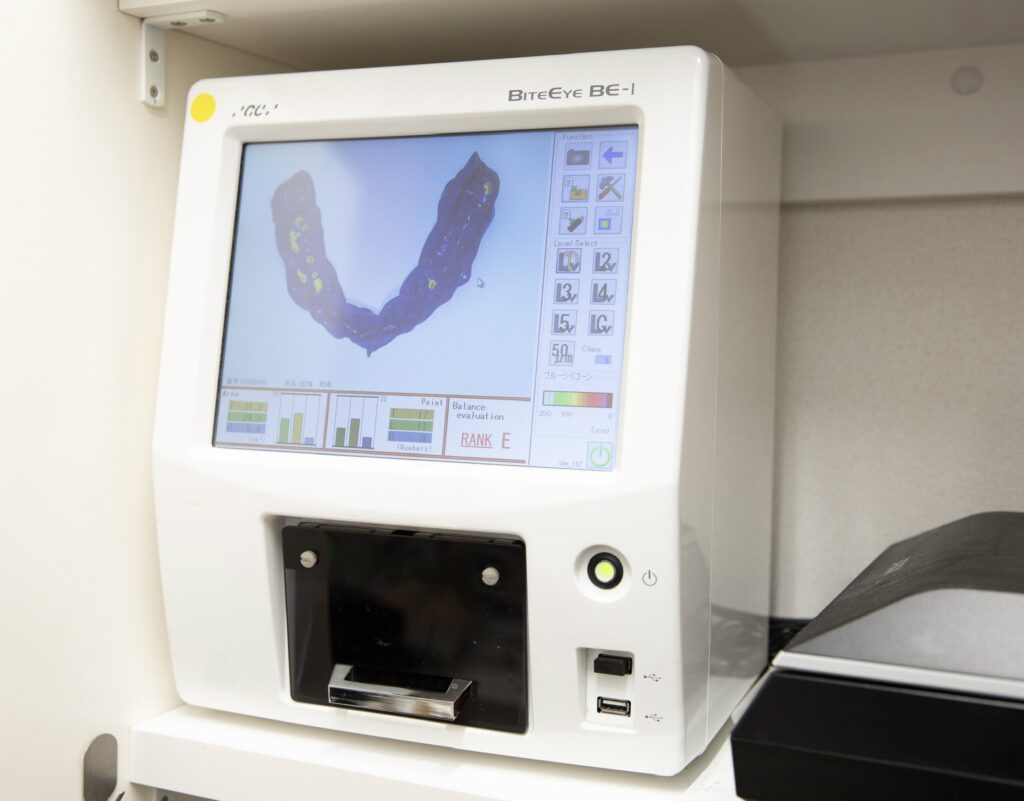 歯接触分析装置バイトアイ（BiteEye）による咬合接触の評価